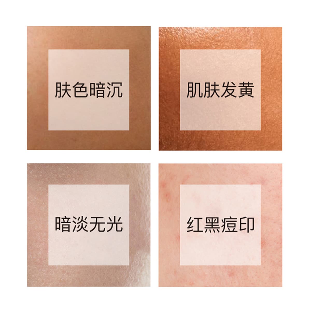 Оригинальный раствор транексамовой кислоты для салона красоты для удаления черных пятен и улучшения меланина, полный набор...