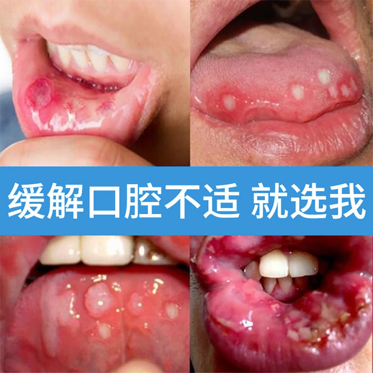 Антибактериальная жидкость для полости рта с витамином С Lotus от боли в горле, воспаления, антибактериального и...